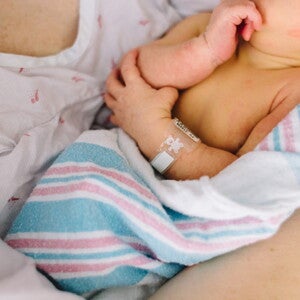 Ictericia neonatal