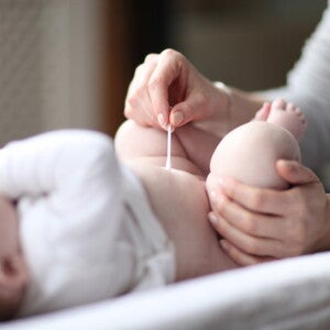 Cordón umbilical