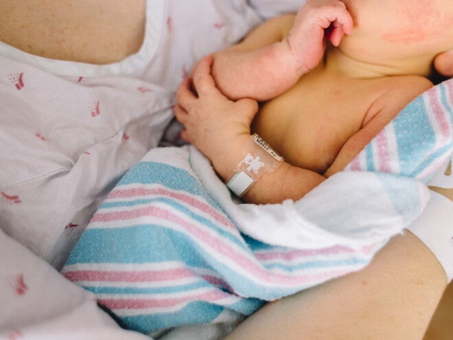 Ictericia neonatal Ictericia neonatal